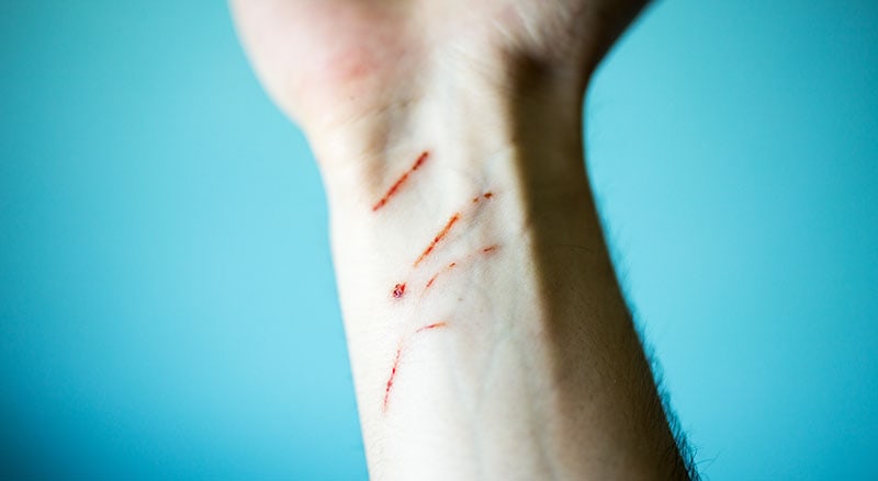 Why Do Cat Scratches Itch? 5 Vet-Approved Reasons | PangoVet