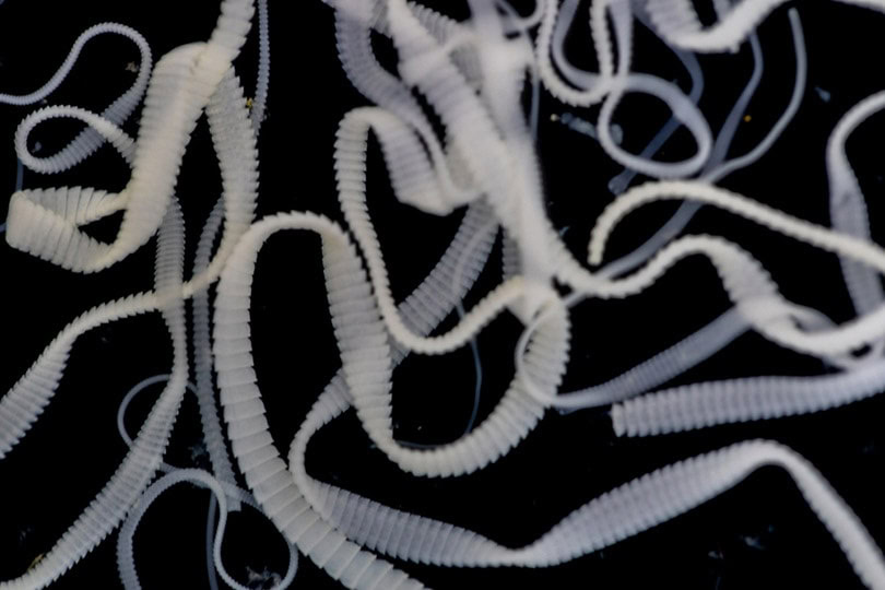 What Diseases Can I Catch From My Cat? (Vet Approved) PangoVet