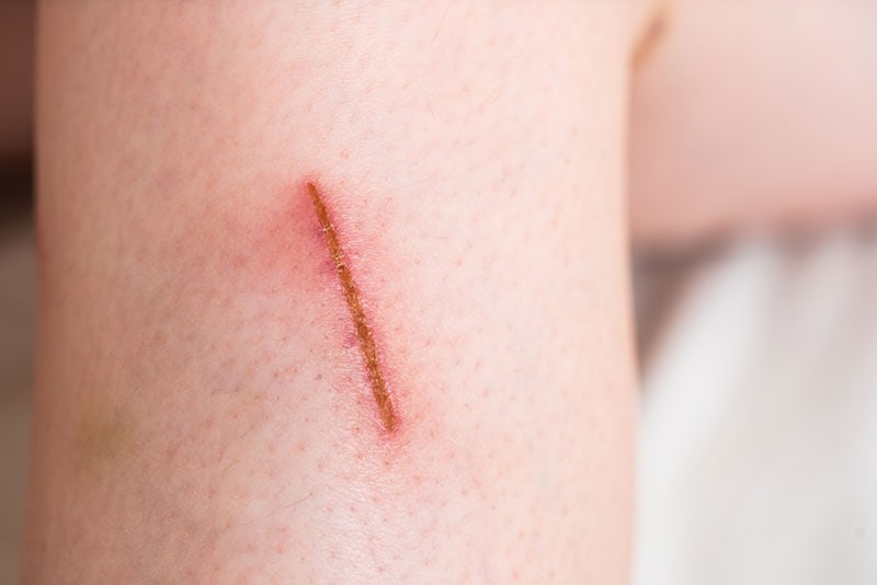 Why Do Cat Scratches Itch? 5 Vet-Approved Reasons | PangoVet